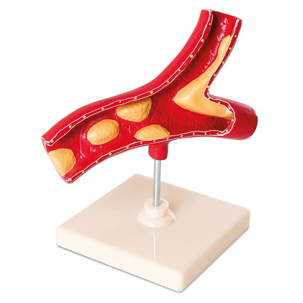 Nowa Szkola Artery model, on stand