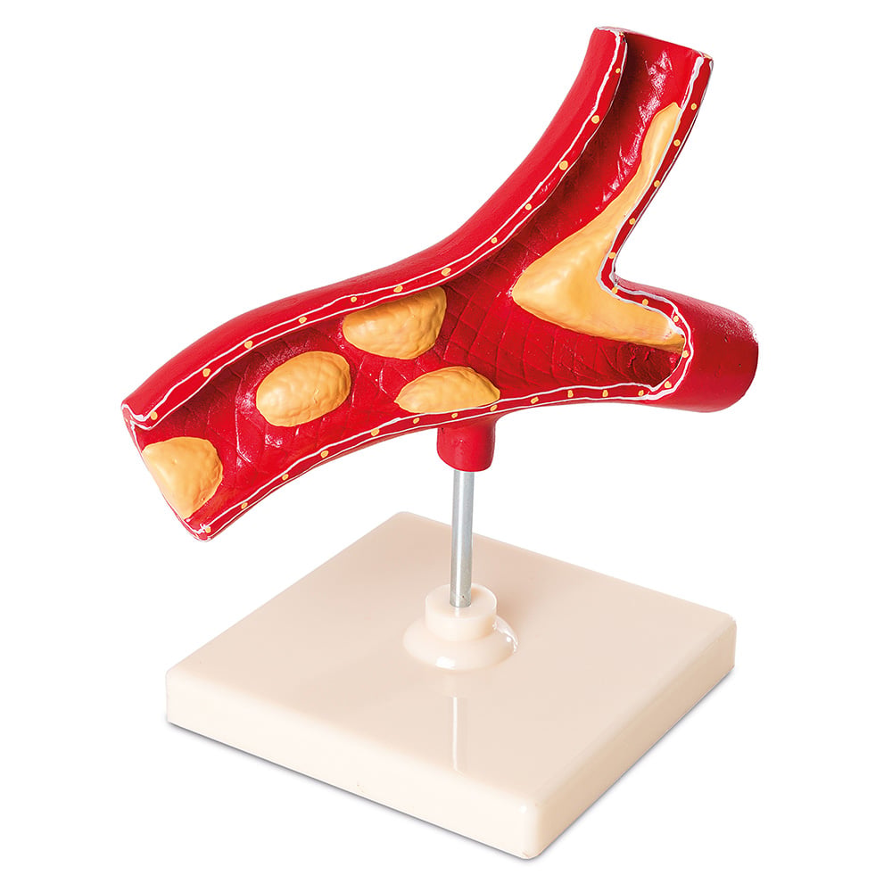 Nowa Szkola Artery model, on stand